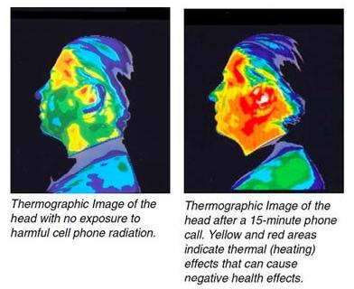 Cellphone Radiation A Growing Risk